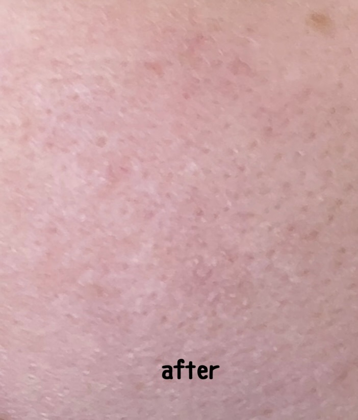 レチノール　シカ　リペア　セラム/innisfree/美容液を使ったクチコミ（3枚目）