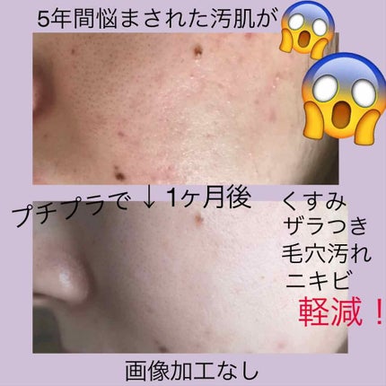 ミノン アミノモイスト モイストチャージ ミルク/ミノン/乳液を使ったクチコミ(1枚目)