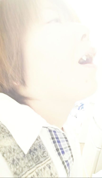 ネイルチップオーバルタイプ/DAISO/ネイルチップ・パーツを使ったクチコミ(1枚目)