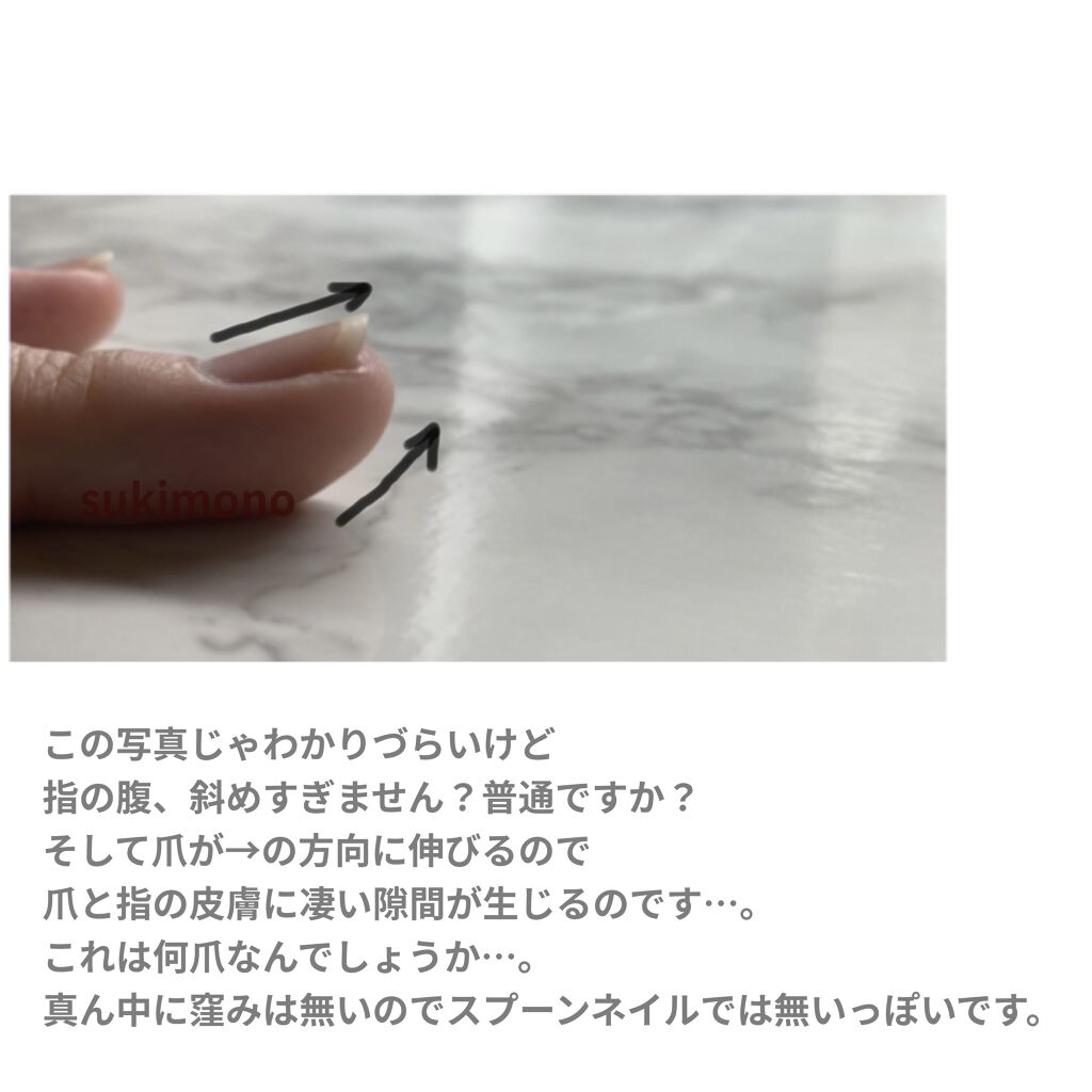 ピュアビューエッセンスHY ヒアルロン酸/ジャパンギャルズ/美容液を使ったクチコミ（3枚目）