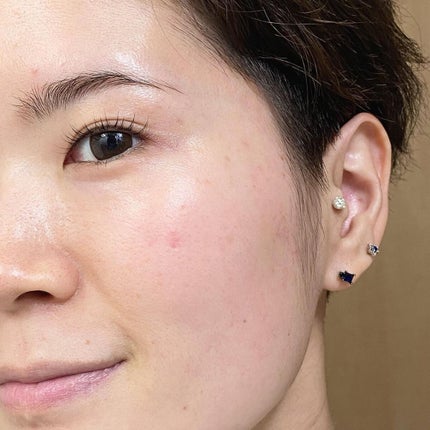 ドクダミ 77 スージングトナー/Anua/化粧水を使ったクチコミ(8枚目)