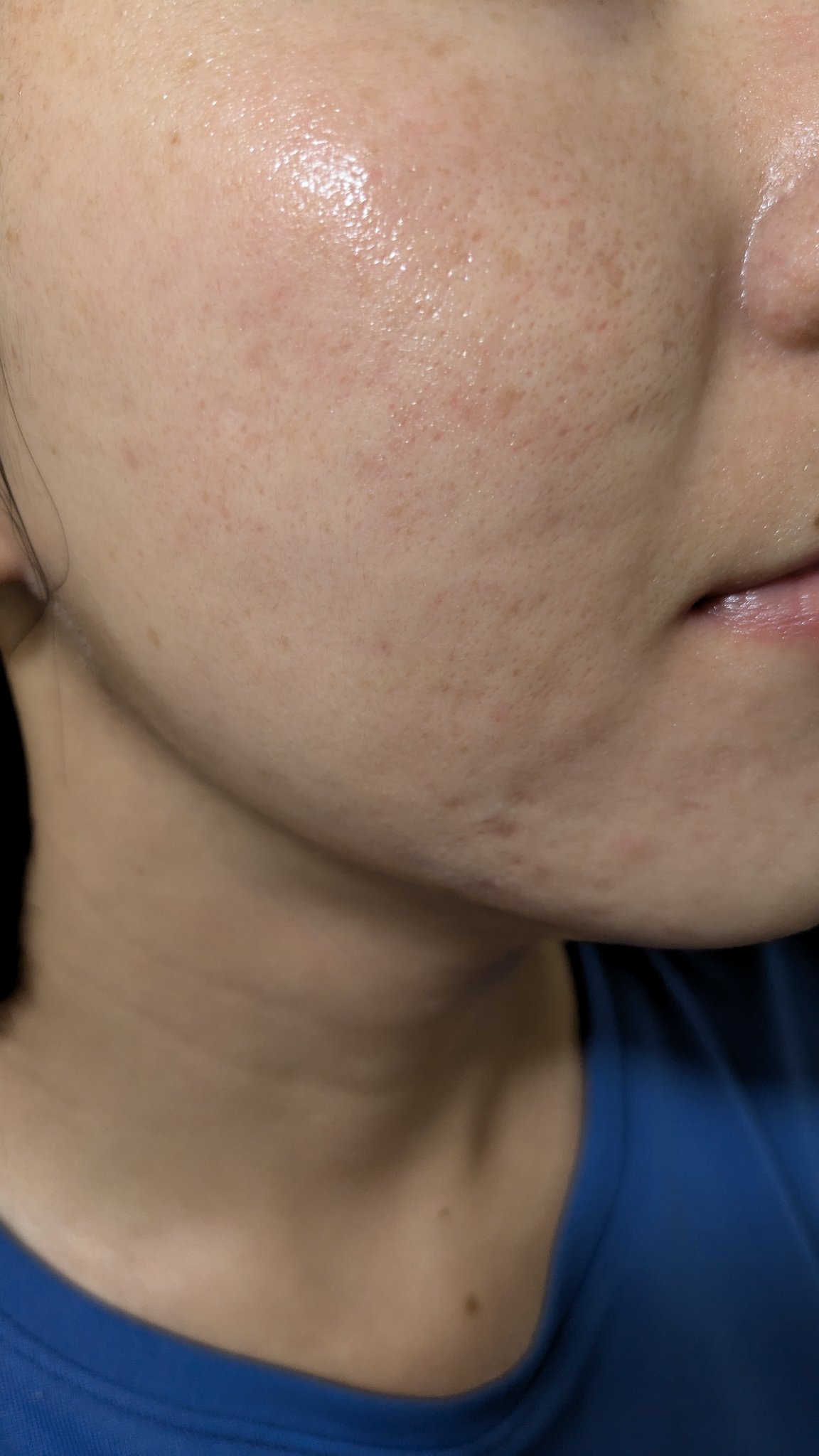 A2+NAG2ソリューション/The Ordinary/美容液を使ったクチコミ（1枚目）