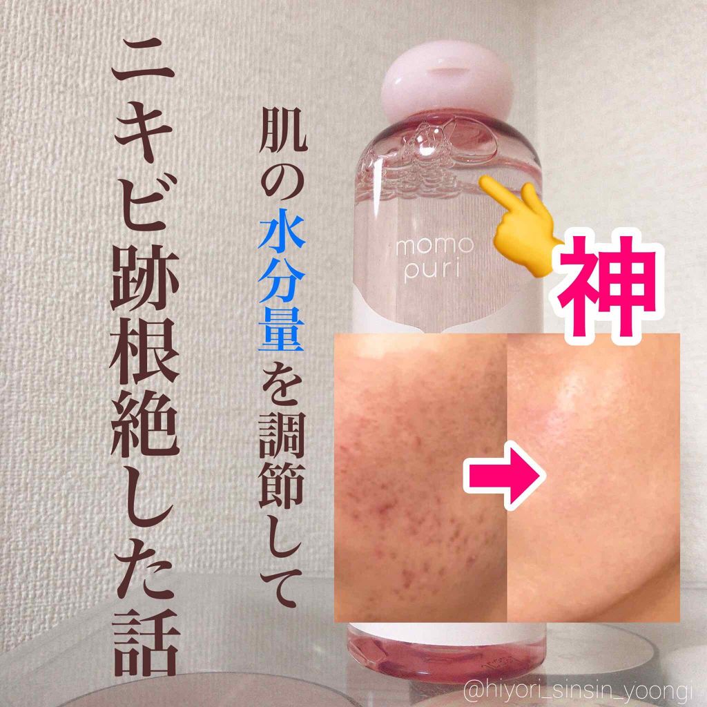 潤い化粧水 ももぷりの口コミ オイリー肌におすすめの化粧水 Momopuri By Hiyori Lips