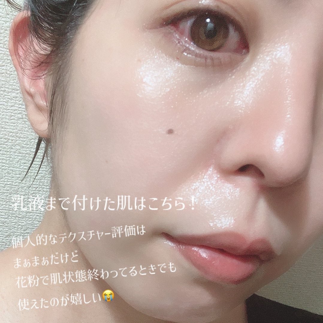 ãã€ã ãã©ã³ã·ã³ã°ããããïŒå»è¬éšå€åïŒïŒåç²§æ¶²ïŒ/ãã¡ã³ã±ã«/åç²§æ°Žã䜿ã£ãã¯ãã³ãïŒ5æç®ïŒ