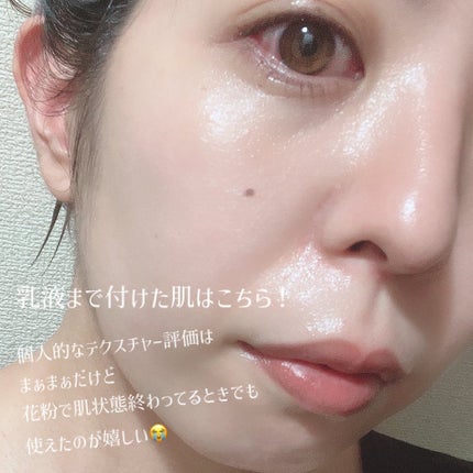 ãã€ã ãã©ã³ã·ã³ã°ããããïŒå»è¬éšå€åïŒïŒåç²§æ¶²ïŒ/ãã¡ã³ã±ã«/åç²§æ°Žã䜿ã£ãã¯ãã³ãïŒ5æç®ïŒ