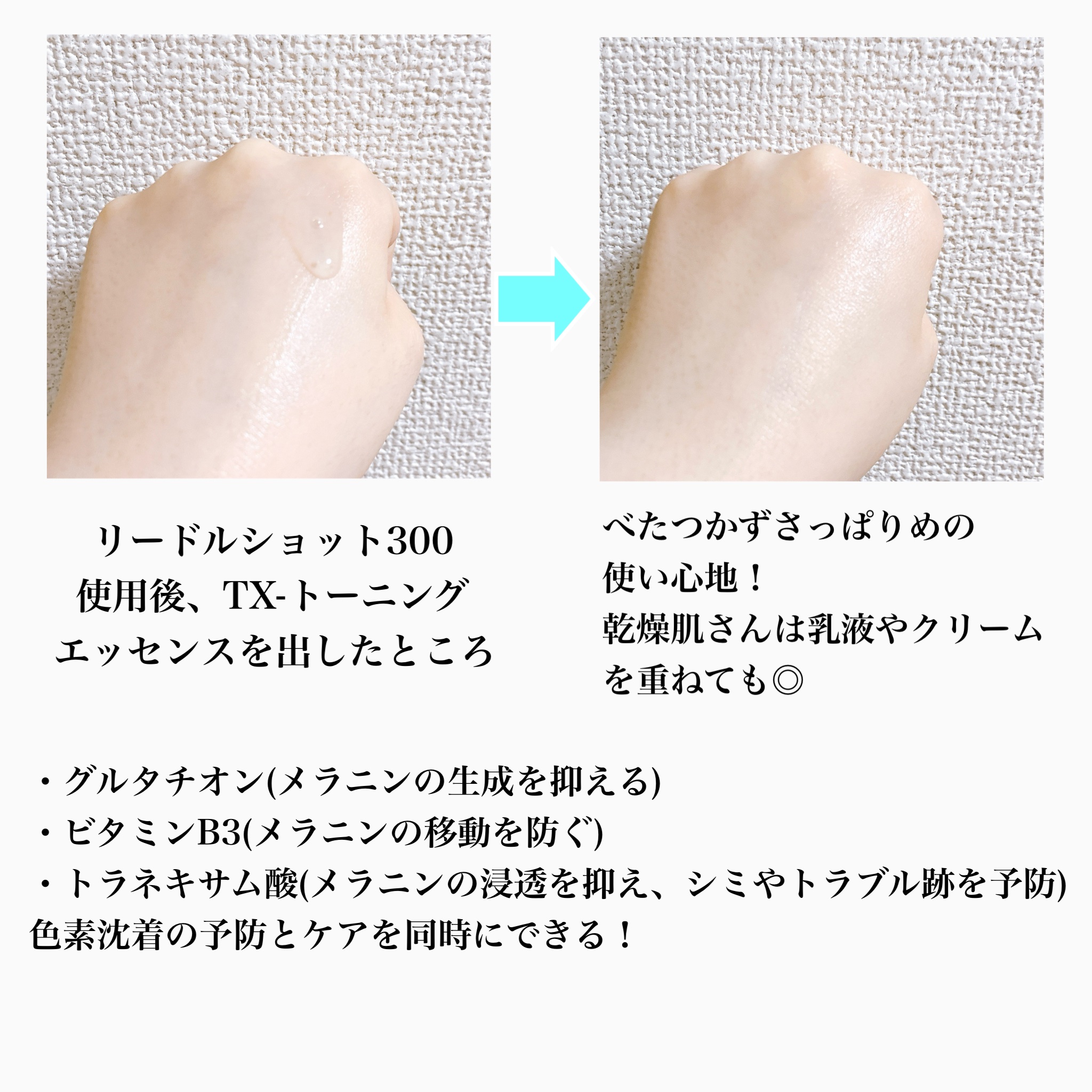 リードルショット300/VT/美容液を使ったクチコミ（2枚目）