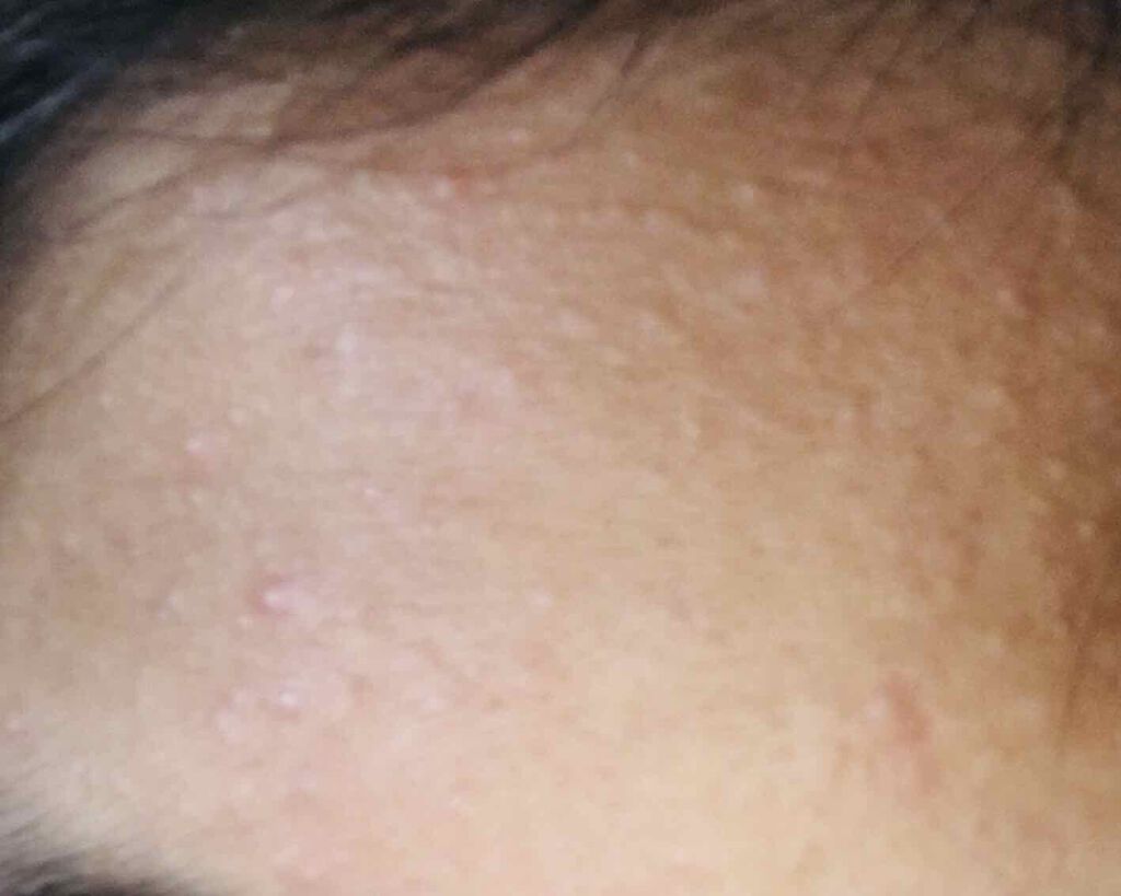 りず on LIPS 「りずの肌日記!初投稿や今回の2枚目見ていただければお分かり頂け..」(2枚目)