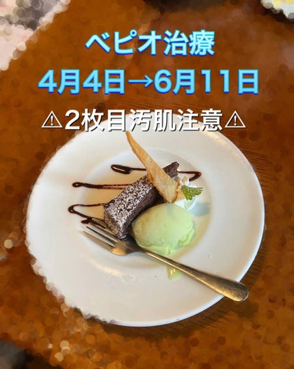 ロゼット洗顔パスタ 海泥スムース/ロゼット/洗顔フォームを使ったクチコミ(1枚目)