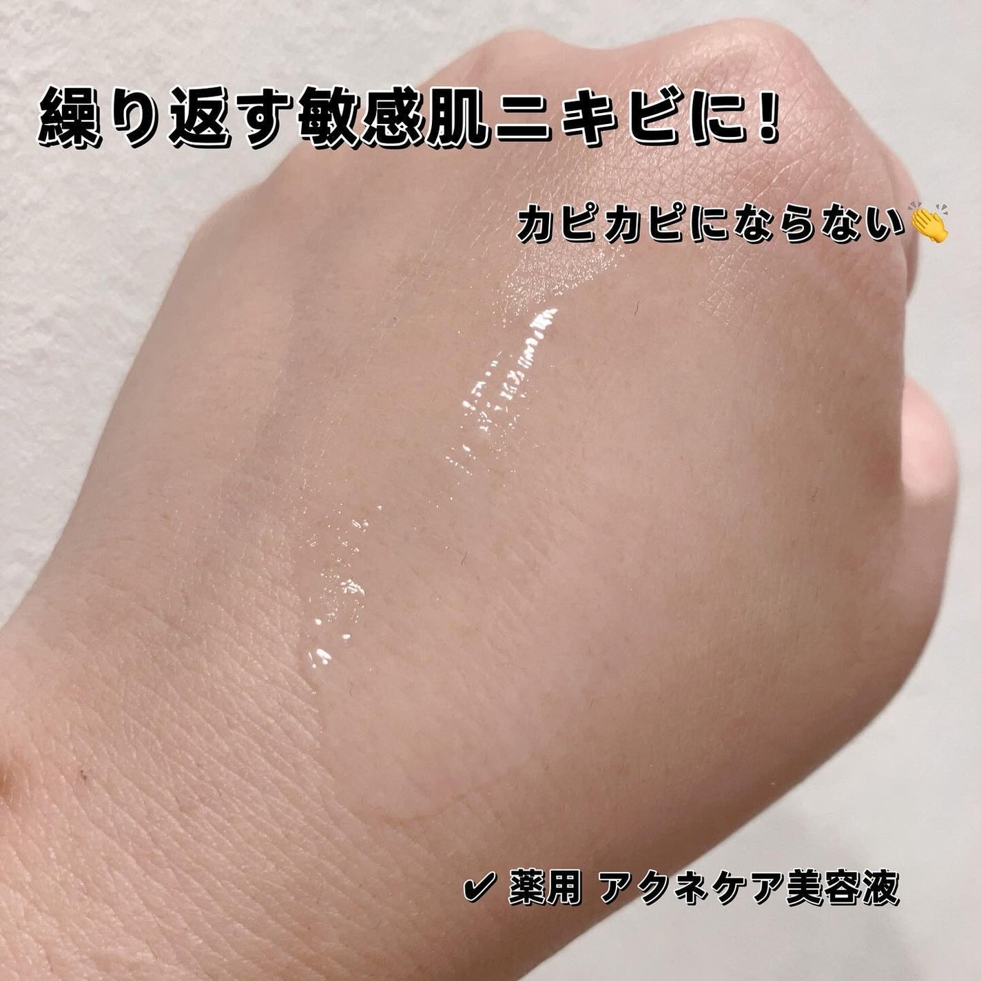 エッセンスイン クレンジングフォーム/d プログラム/洗顔フォームを使ったクチコミ(4枚目)