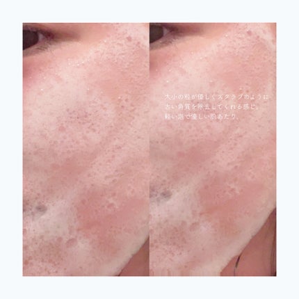 ブレミッシュ 酵素 洗顔パウダー/PAPA RECIPE/洗顔パウダーを使ったクチコミ(4枚目)