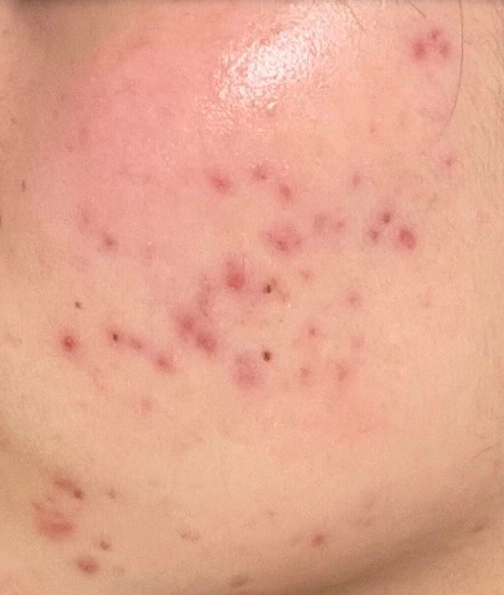 イハダ 薬用バーム【医薬部外品】/IHADA/フェイスバームを使ったクチコミ(2枚目)