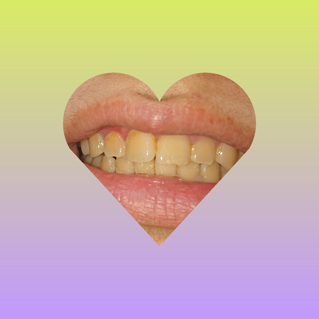 ホワイティエッセンス/MiiS/その他オーラルケアを使ったクチコミ(2枚目)