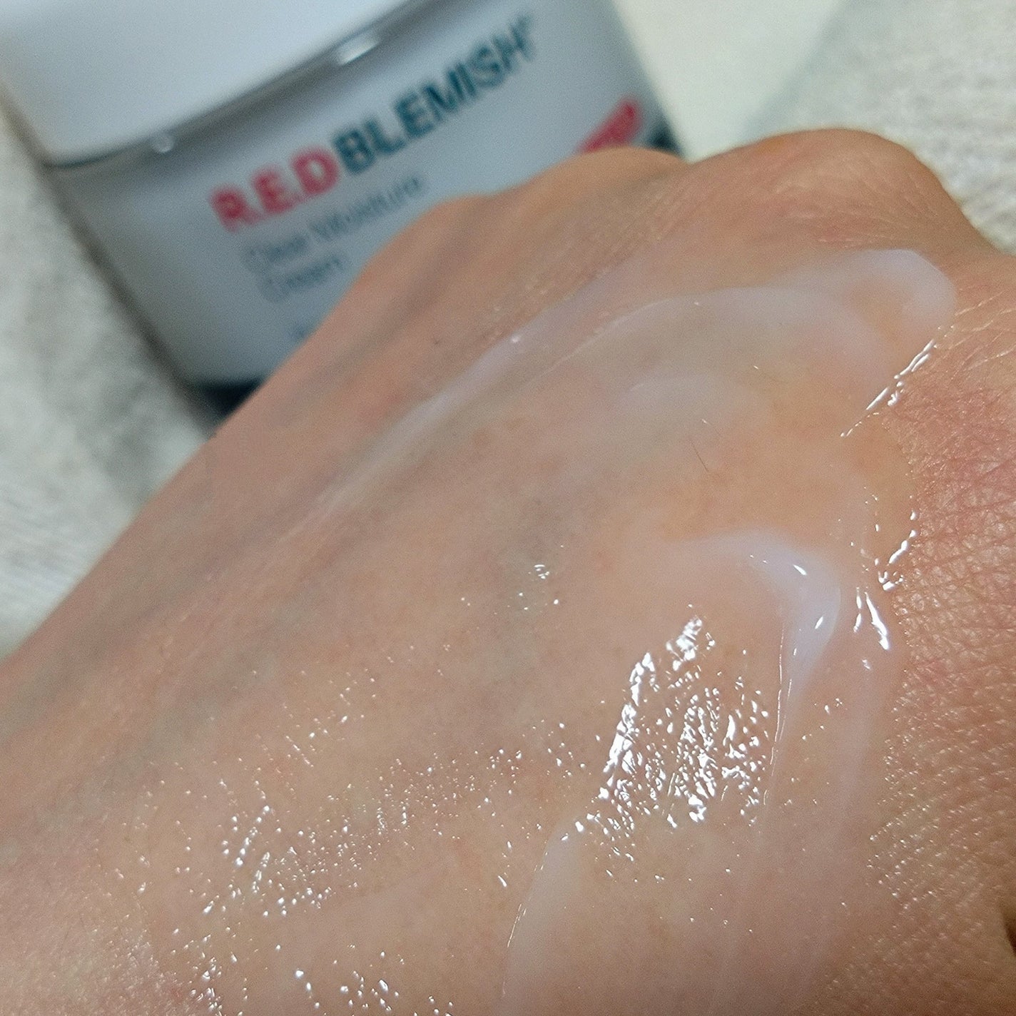 レッドブレミッシュ クリアモイスチャークリーム/Dr.G/フェイスクリームを使ったクチコミ(6枚目)