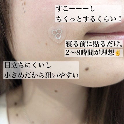 ACマグネシウムパッチ ミニ/スノーツープラス/にきびパッチを使ったクチコミ(4枚目)