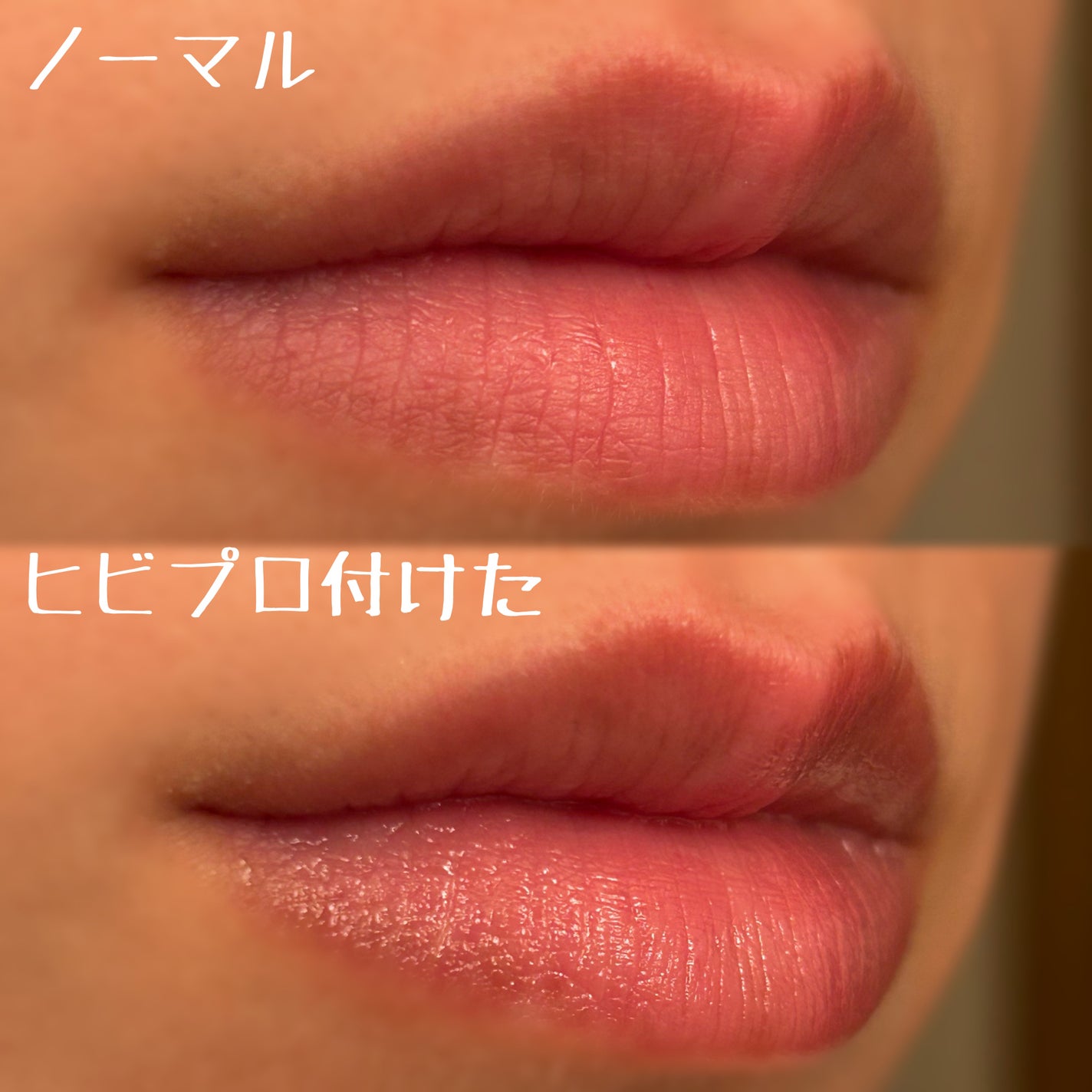 ヒビプロLP(医薬品)/メンソレータム/その他を使ったクチコミ(3枚目)