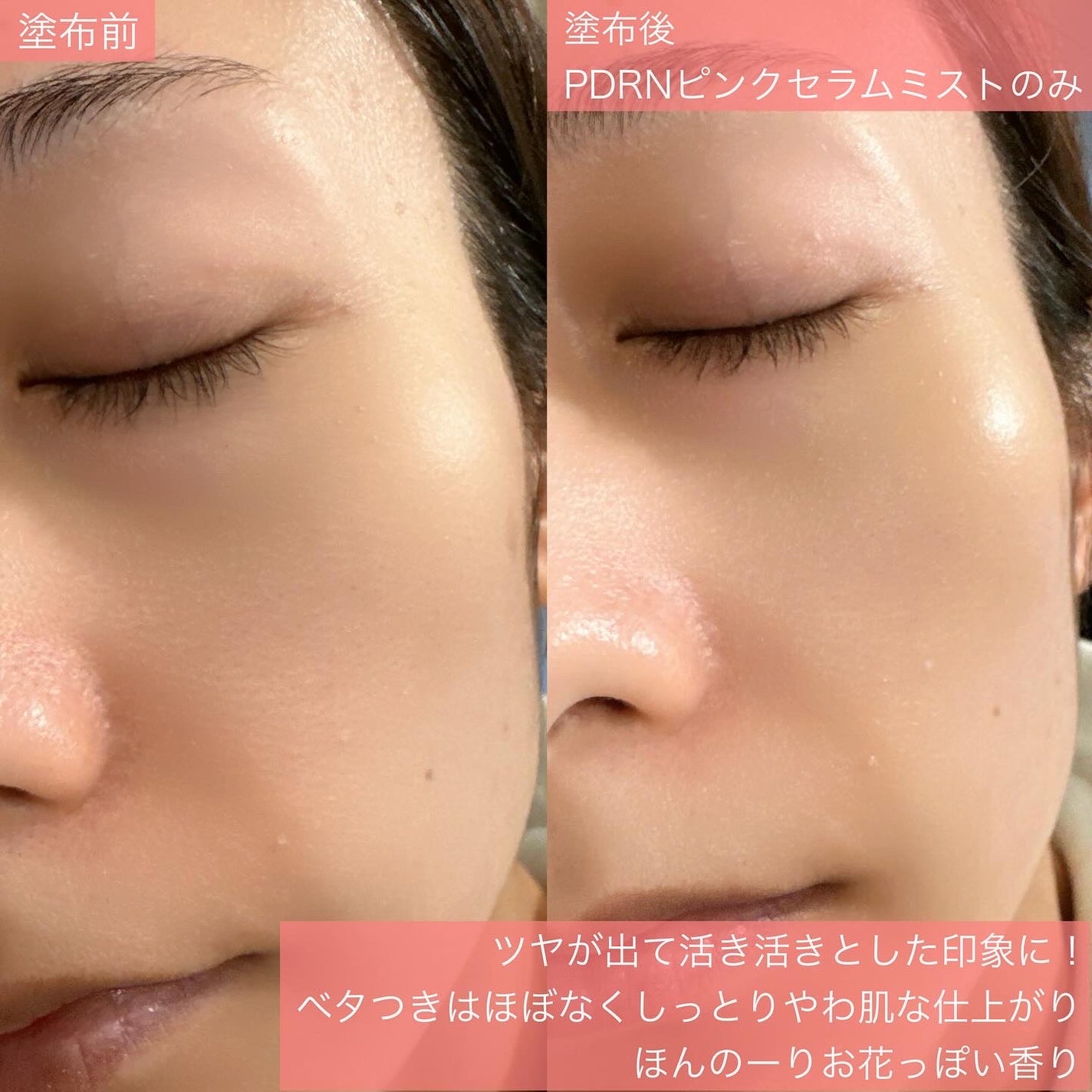 PDRNピンクセラムミスト/MEDICUBE/美容液を使ったクチコミ(6枚目)