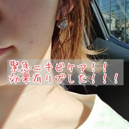 モイスチャー ミストローションII(しっとり)/アルージェ/ミスト状化粧水を使ったクチコミ(1枚目)