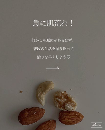 乾燥さん 薬用しっとりクリーム 【医薬部外品】/乾燥さん/フェイスクリームを使ったクチコミ(2枚目)