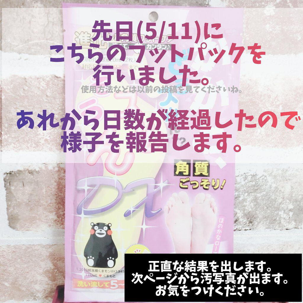 かかと どうスルん??そうスルんDX/Stay Free/レッグ・フットケアを使ったクチコミ(2枚目)