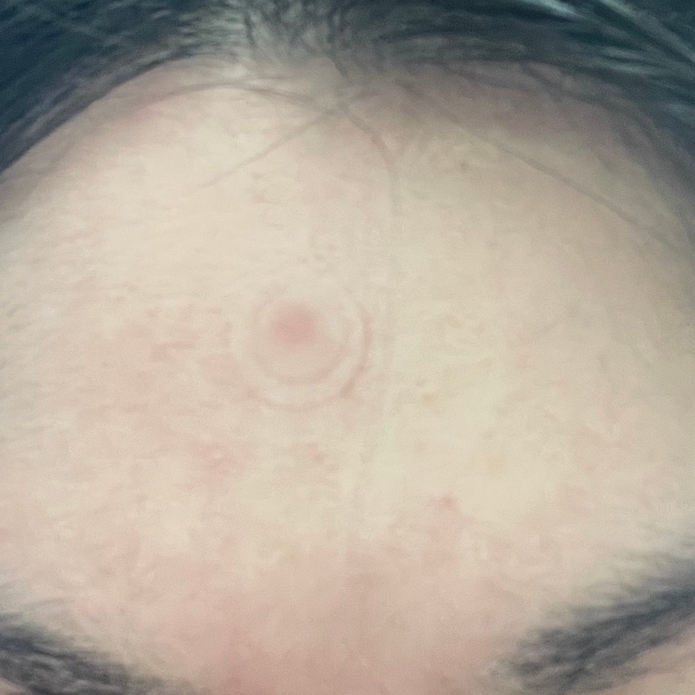 ゼロスポットパッチCICA/Today’s Cosme/その他スキンケアを使ったクチコミ(4枚目)