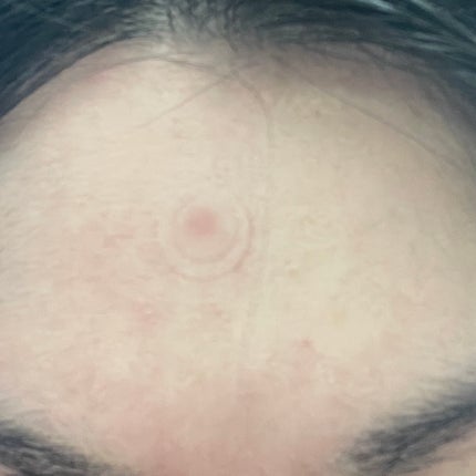 ゼロスポットパッチCICA/Today’s Cosme/その他スキンケアを使ったクチコミ(4枚目)