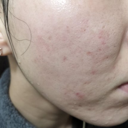 を使ったクチコミ(1枚目)