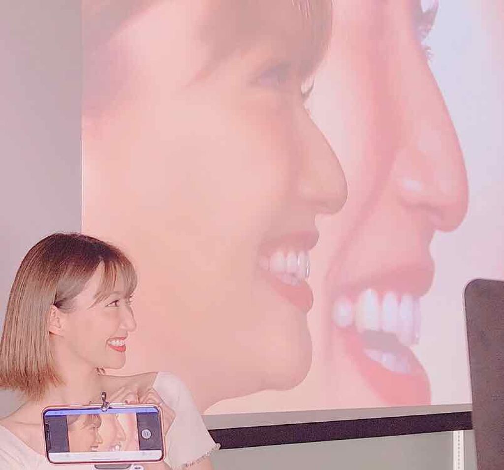 パーフェクトツイーザー/D-UP/その他化粧小物を使ったクチコミ（3枚目）