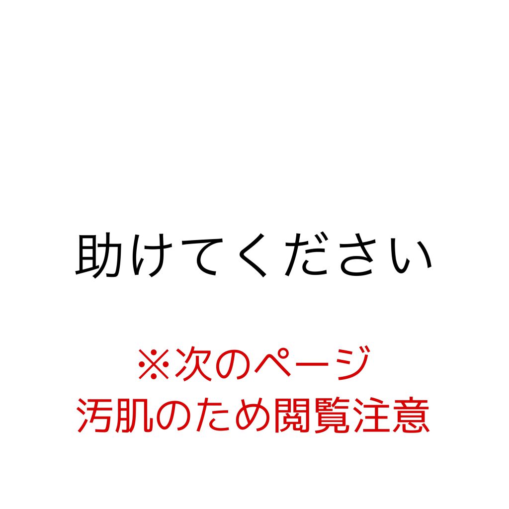サラ on LIPS 「助けてください。。こんな汚い肌を載せてしまってすみません。これ..」(1枚目)