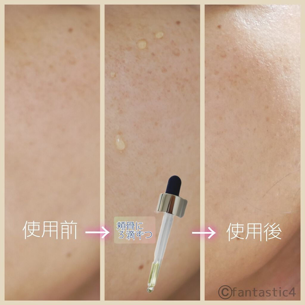 ザビタミンC23/IOPE/美容液を使ったクチコミ(4枚目)