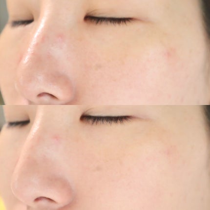 フローレス ルミエール ラディアンス パーフェクティング クッション/ローラ メルシエ/クッションファンデーションを使ったクチコミ(8枚目)