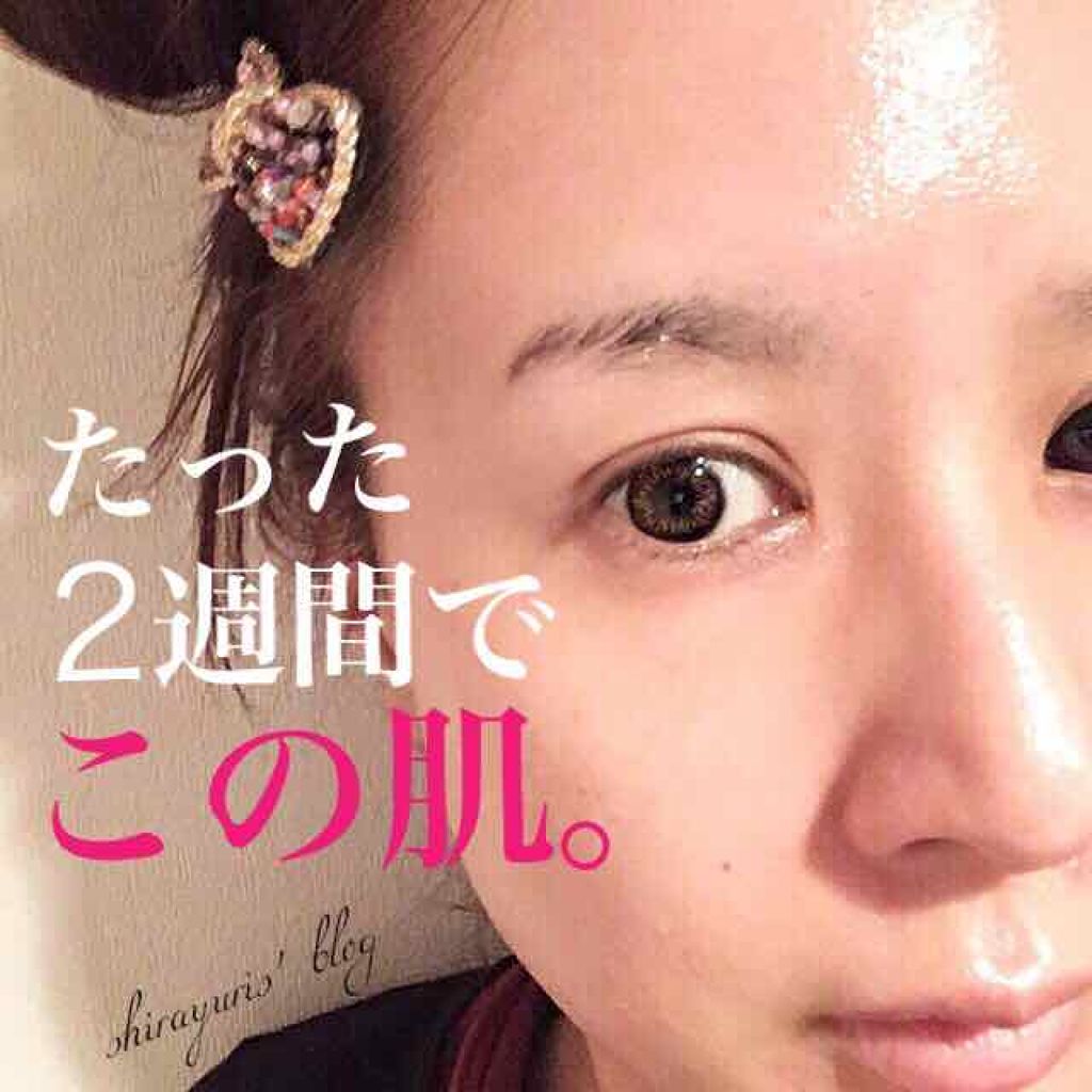 BEBETOXアンプルセット/YOU&ME/スキンケアキットを使ったクチコミ(1枚目)