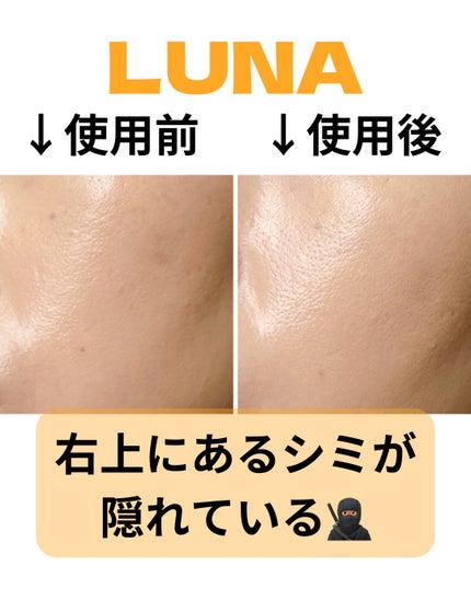 ロングラスティングチップコンシーラーフィックシングフィット/LUNA/リキッドコンシーラーを使ったクチコミ(2枚目)