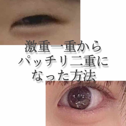 アイトーク/アイトーク/二重まぶた用アイテムを使ったクチコミ(1枚目)