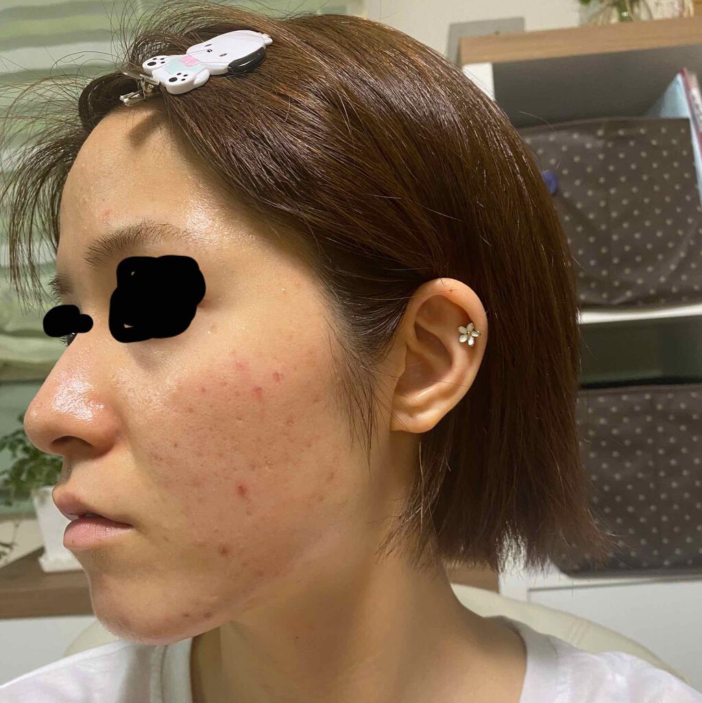 DHC ビタミンCハードカプセル/DHC/美容サプリメントを使ったクチコミ(3枚目)