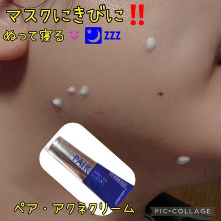 ペアアクネクリームW(医薬品)/ペア/その他を使ったクチコミ(1枚目)
