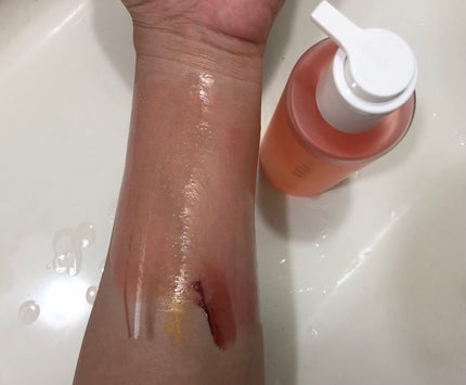 ネネコ on LIPS 「Kopherレッドチノールリセットエージ🧡めちゃくちゃいいアロ..」(7枚目)