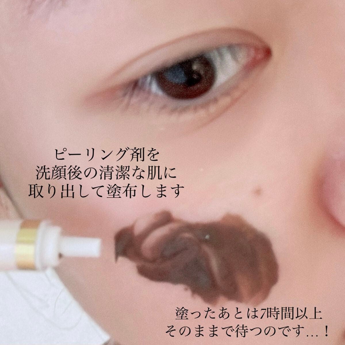 ダーマスキンピーリング/BQCELL/その他キットセットを使ったクチコミ(3枚目)