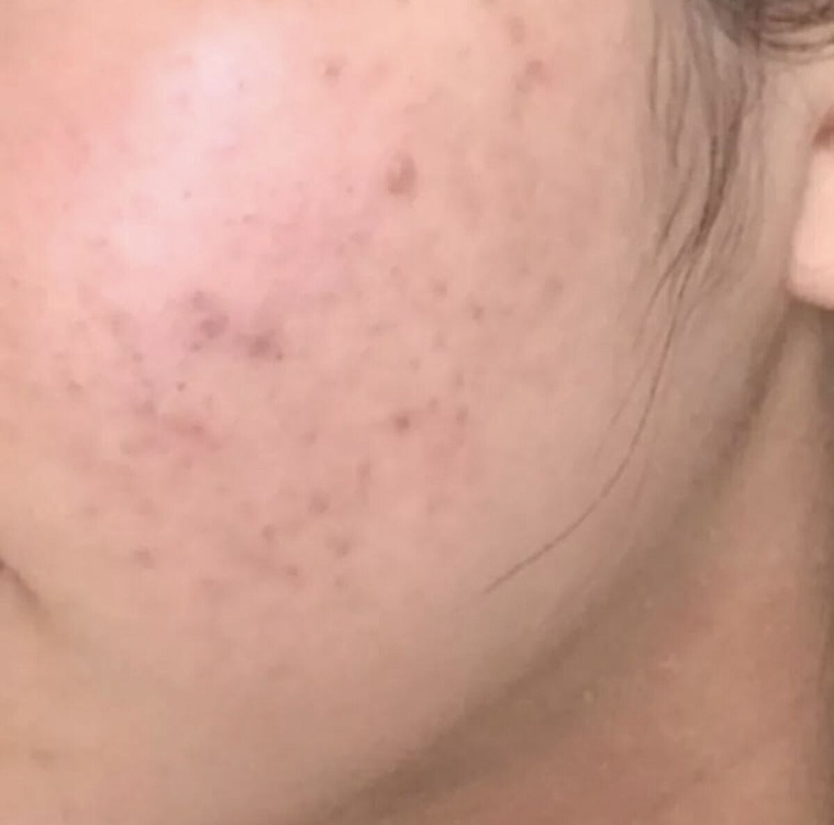 フレッシュリージュースドビタミンドロップ(35ml)/Klairs/美容液を使ったクチコミ（2枚目）