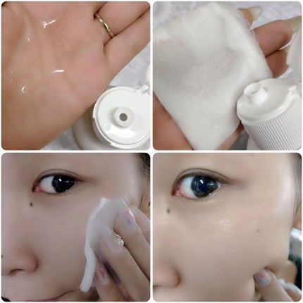 オードムーゲ 薬用ローション(ふきとり化粧水)/オードムーゲ/拭き取り化粧水を使ったクチコミ(3枚目)