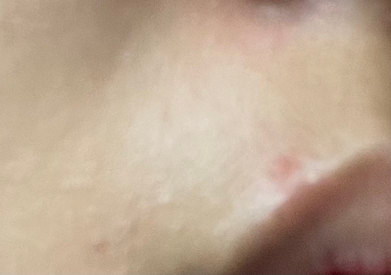 薬用 しみ 集中対策 美容液/メラノCC/美容液を使ったクチコミ(4枚目)