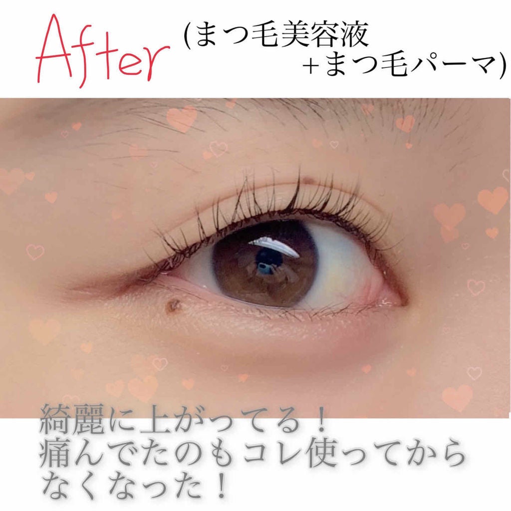 エグータム/アルマダスタイル/まつげ美容液を使ったクチコミ(3枚目)