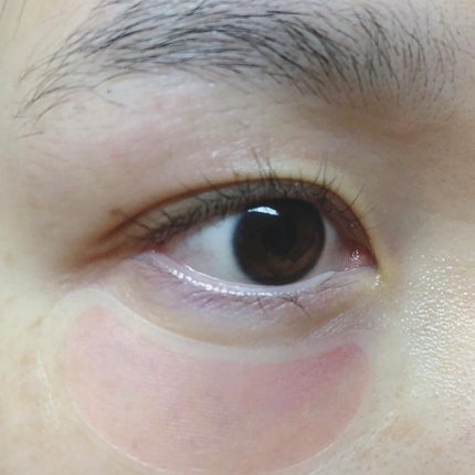 ステムトリートメント ニードルセラム/Reinca/シートマスク・パックを使ったクチコミ(7枚目)