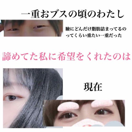 ORIPUCHI/Girl's Maker/二重まぶた用アイテムを使ったクチコミ(1枚目)