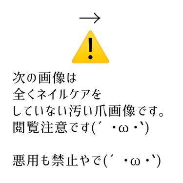 クイックケアコート/ettusais/ネイルオイル・トリートメントを使ったクチコミ（2枚目）