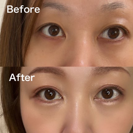 メザイク クリップ カッター ファイバー専用カッター/メザイク/二重まぶた用アイテムを使ったクチコミ(6枚目)