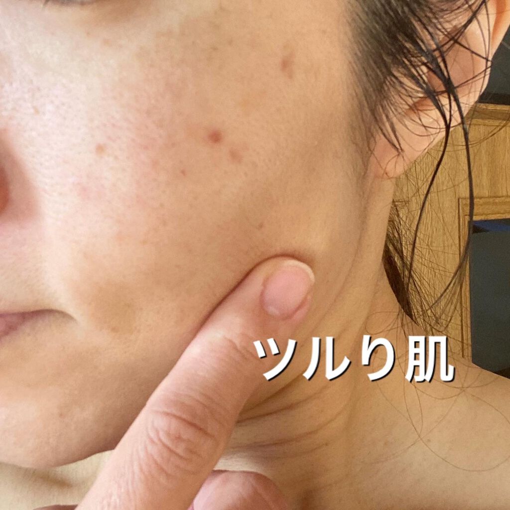 KC むきタマつるん 発泡美容液クレンジング/ハーブ健康本舗/クレンジングジェルを使ったクチコミ(7枚目)