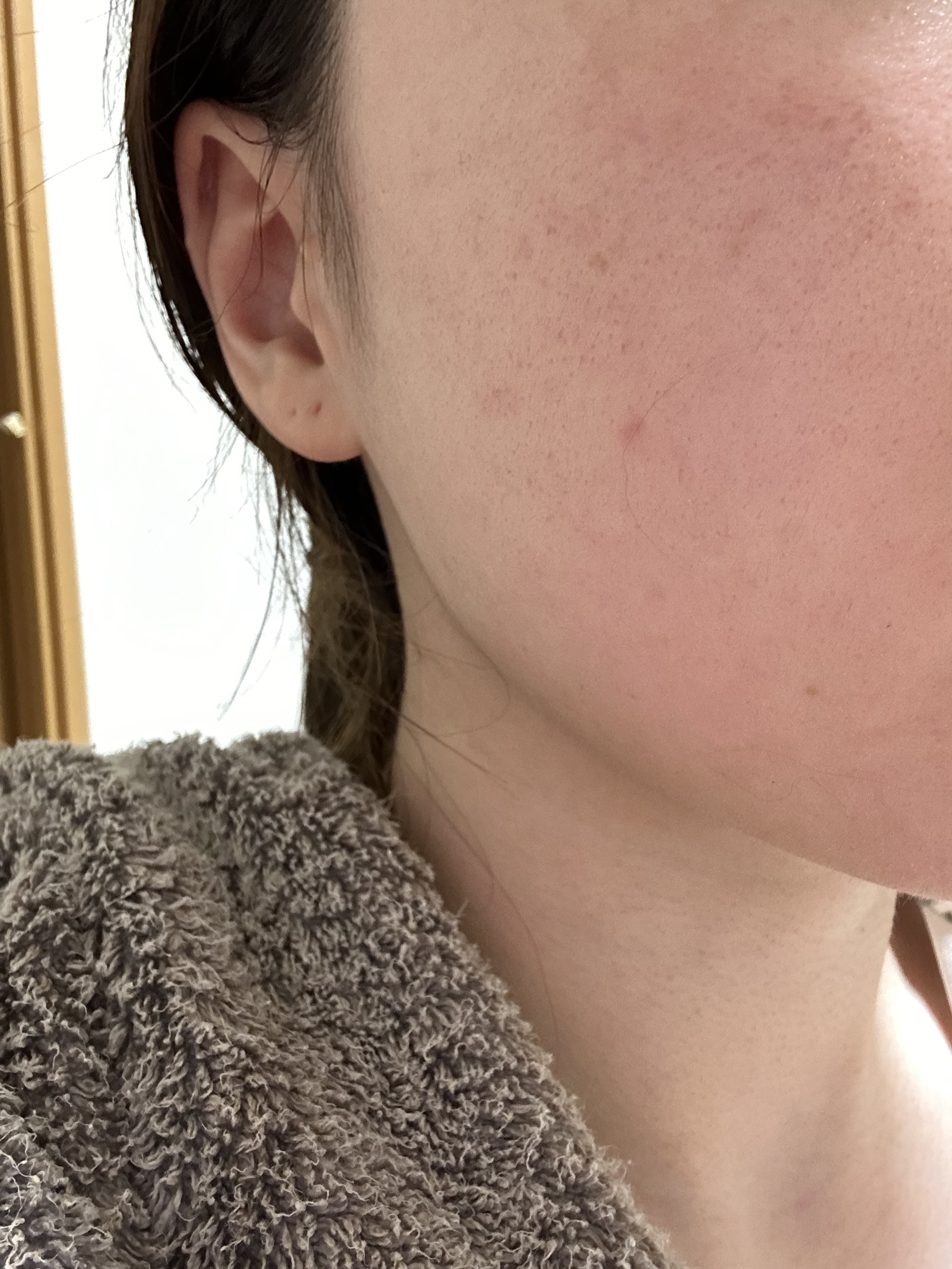 薬用しみ集中対策 プレミアム美容液/メラノCC/美容液を使ったクチコミ（2枚目）