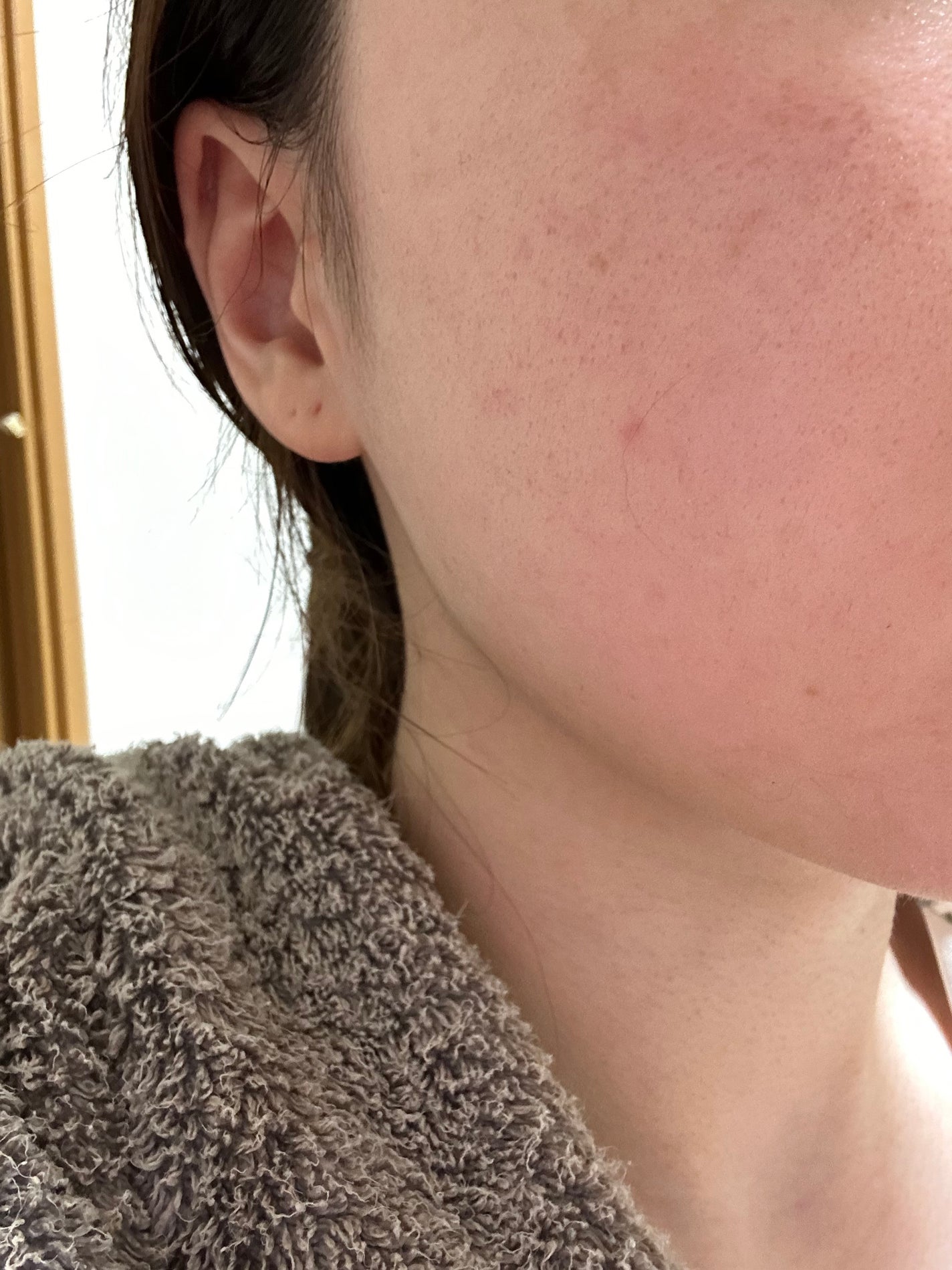 薬用しみ集中対策 プレミアム美容液/メラノCC/美容液を使ったクチコミ(2枚目)