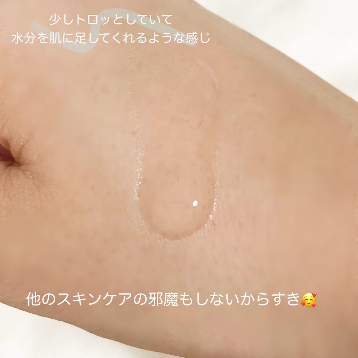 ピンクティーツリーシナジーセラム/APLIN/美容液を使ったクチコミ（3枚目）