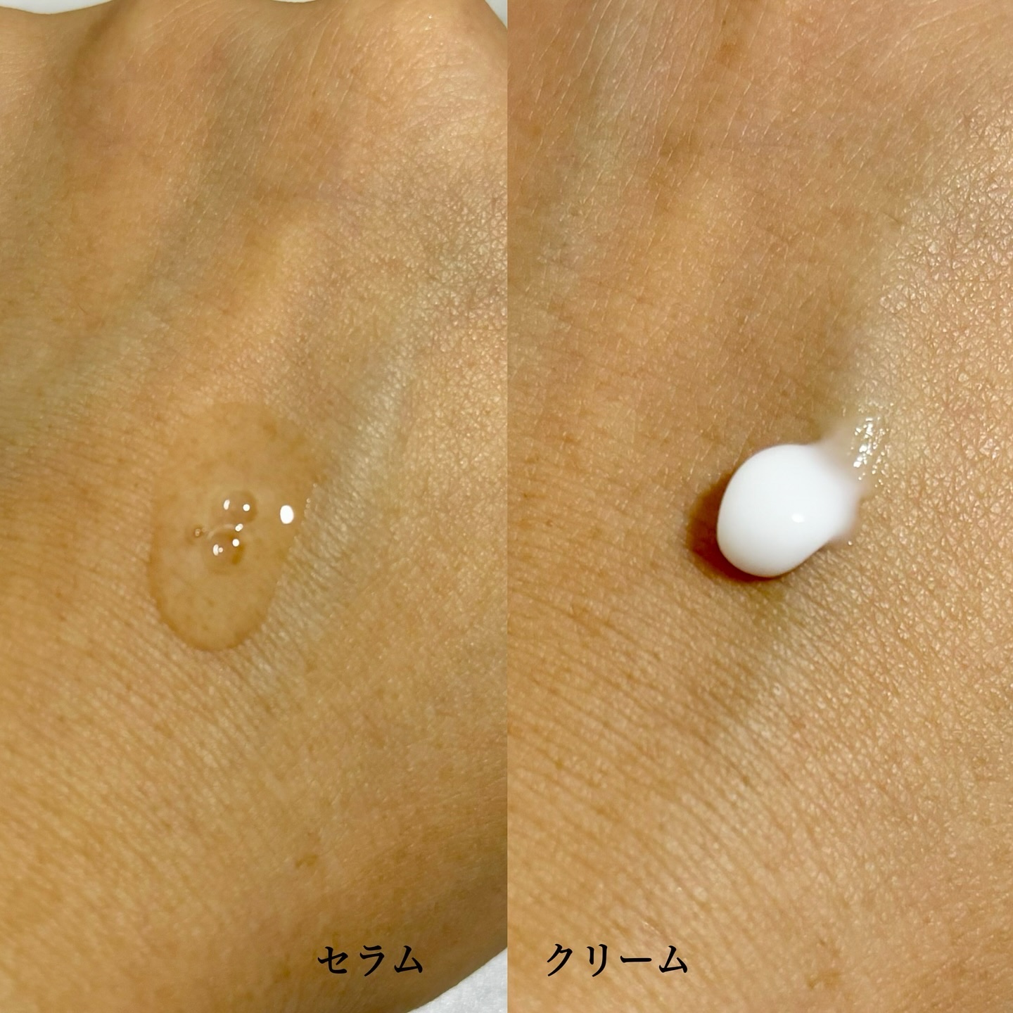 ノスカナイン トラブル セラム/FATION/美容液を使ったクチコミ（2枚目）